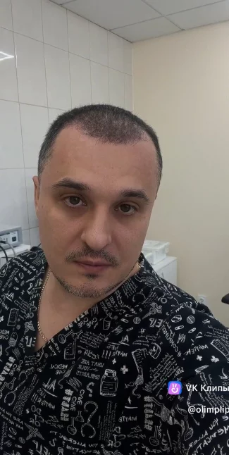 Как оценить результат лечения аденоидов: фото и видео до и после